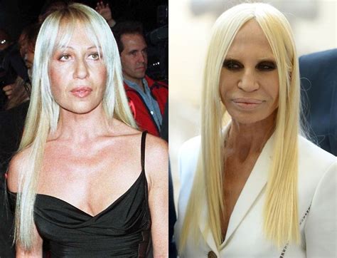 donatella versace young 1990|donatella versace before and after surgery.